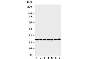Western blot testing of SIP antibody and Lane 1:  rat liver (CACYBP anticorps  (Middle Region))