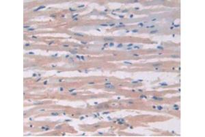 IHC-P analysis of Rat Heart Tissue, with DAB staining.