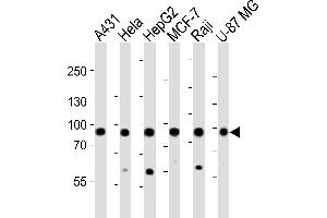 Western blot analysis of lysates from A431, Hela, HepG2, MCF-7, Raji, U-87 MG cell line (from left to right), using IT Antibody (Center) (ABIN6242975 and ABIN6577493). (IMMT anticorps  (AA 170-203))