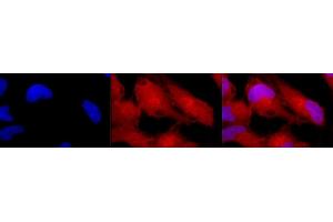 Immunocytochemistry/Immunofluorescence analysis using Rabbit Anti-Erk1/2 Polyclonal Antibody (ABIN361832 and ABIN361833).
