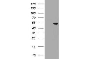 Image no. 6 for anti-Selenium Binding Protein 1 (SELENBP1) antibody (ABIN1500860)