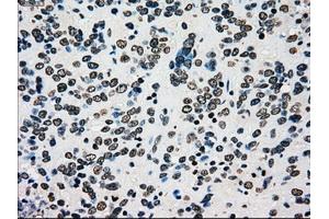 Image no. 10 for anti-Premelanosome Protein (PMEL) antibody (ABIN1500300)