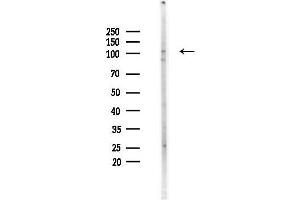 Western blot analysis of lysates from HUVEC cells(heat-shock,45 min treatment), using WBSCR11 Antibody at 1/1000 dilution.