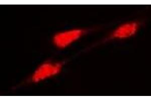 Immunofluorescent analysis of DLGAP5 staining in Hela cells. (DLGAP5 anticorps)