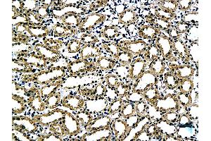Formalin-fixed and paraffin embedded rat kidney tissue labeled with Anti-Claudin 5 Polyclonal Antibody, Unconjugated (ABIN673869) followed by conjugation to the secondary antibody and DAB staining (Claudin 5 anticorps)