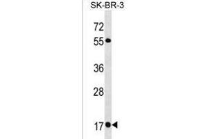 RAB19 Antibody (N-term) (ABIN1538880 and ABIN2850090) western blot analysis in SK-BR-3 cell line lysates (35 μg/lane). (RAB19 anticorps  (N-Term))