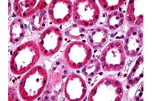 IHC Information: Paraffin embedded renaltubules tissue, tested with an antibody dilution of 5 ug/ml.