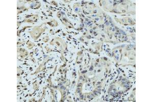IHC analysis of SCP3/SYCP3 using anti-SCP3/SYCP3 antibody (ABIN7602415). (SYCP3 anticorps  (AA 75-236))
