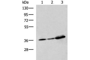 Western blot analysis of A549 A172 and HepG2 cell lysates using EEF1D Polyclonal Antibody at dilution of 1:950
