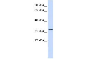 Tropomyosin 1 antibody used at 1 ug/ml to detect target protein. (Tropomyosin anticorps)