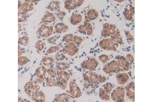 Used in DAB staining on fromalin fixed paraffin- embedded stomach tissue