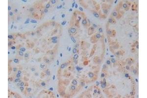 Detection of HO1 in Human Kidney Tissue using Monoclonal Antibody to Heme Oxygenase 1 (HO1)