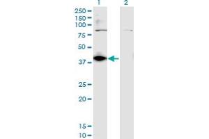 Western Blot analysis of DHDH expression in transfected 293T cell line by DHDH monoclonal antibody (M03), clone 3A11. (DHDH anticorps  (AA 235-334))