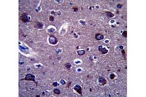 Anti-APP antibody immunohistochemistry analysis in formalin fixed and paraffin embedded human brain tissue.