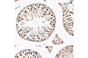 Immunohistochemistry of paraffin-embedded mouse testis using CBX6 antibody (ABIN6127558, ABIN6138026, ABIN6138027 and ABIN6221185) at dilution of 1:100 (40x lens). (CBX6 anticorps  (AA 80-180))