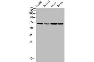 Western blot analysis of HepG2 JK Colo Hela using TRMT11 antibody. (Trmt11 anticorps  (C-Term))