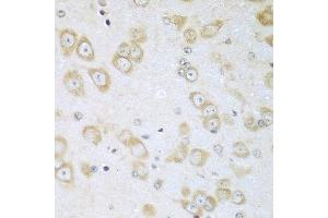 Immunohistochemistry of paraffin-embedded mouse brain using ACOX1 antibody at dilution of 1:100 (40x lens). (ACOX1 anticorps)