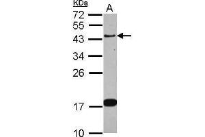 WB Image Sample (30 ug of whole cell lysate) A: IMR32 12% SDS PAGE antibody diluted at 1:1000 (GAP43 anticorps)