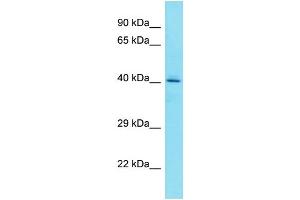Host: Rabbit Target Name: FAM203A Sample Type: HepG2 Whole Cell lysates Antibody Dilution: 1.