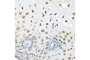 Immunohistochemistry of paraffin-embedded human liver using UBC antibody.