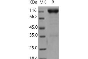 Western Blotting (WB) image for Platelet Derived Growth Factor Receptor beta (PDGFRB) (Active) protein (Fc Tag) (ABIN7197400)