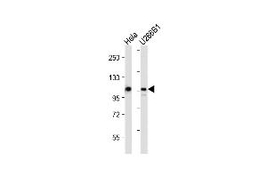 All lanes : Anti-GEN1 Antibody (N-term) at 1:2000 dilution Lane 1: Hela whole cell lysate Lane 2: U266B1 whole cell lysate Lysates/proteins at 20 μg per lane.