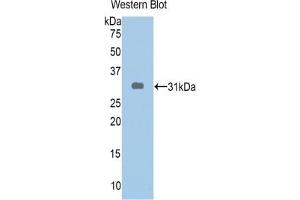 Detection of Recombinant ABCA1, Human using Polyclonal Antibody to ATP Binding Cassette Transporter A1 (ABCA1) (ABCA1 anticorps  (AA 1404-1663))