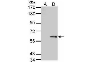 WB Image Western Blot analysis of FPGS expression in transfected 293T cell line by FPGS polyclonal antibody.