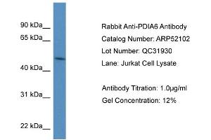 WB Suggested Anti-PDIA6 Antibody Titration: 0. (PDIA6 anticorps  (N-Term))