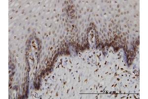Immunoperoxidase of monoclonal antibody to BANF1 on formalin-fixed paraffin-embedded human esophagus.