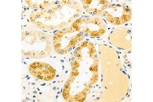Immunohistochemistry of paraffin embedded human kidney using CYP20A1 (ABIN7073675) at dilution of 1: 700 (400x lens)
