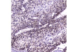 IHC analysis of CLPP using anti-CLPP antibody .