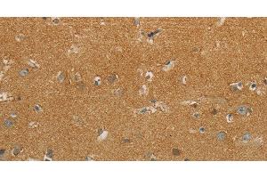 Immunohistochemistry of paraffin-embedded Human brain using GJB6 Polyclonal Antibody at dilution of 1:30