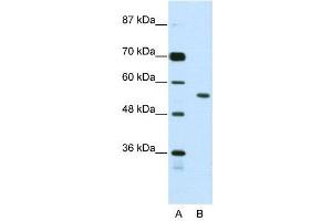 WB Suggested Anti-BRD3  Antibody Titration: 2. (BRD3 anticorps  (N-Term))
