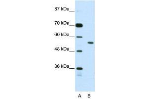 WB Suggested Anti-BRD3  Antibody Titration: 2.