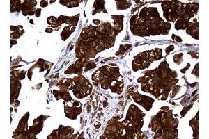 Image no. 4 for anti-Non-Metastatic Cells 1, Protein (NM23A) Expressed in (NME1) antibody (ABIN1499754)