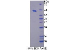 SDS-PAGE analysis of Mouse NCOR1 Protein. (NCOR1 Protéine)