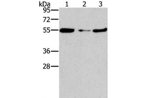 Western Blot analysis of Mouse heart tissue and NIH/3T3 cell, Mouse liver tissue using FGFR1OP Polyclonal Antibody at dilution of 1:850 (FGFR1OP anticorps)