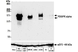 Western Blotting (WB) image for anti-Platelet Derived Growth Factor Receptor alpha (PDGFRA) (AA 24-525) antibody (ABIN7453341)