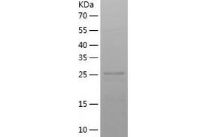 Western Blotting (WB) image for ADAM Metallopeptidase with thrombospondin Type 1 Motif, 18 (ADAMTS18) (AA 712-970) protein (His-IF2DI Tag) (ABIN7121693)