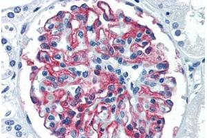 Human Kidney (formalin-fixed, paraffin-embedded) stained with CR1 antibody ABIN337278 at 10 ug/ml followed by biotinylated anti-mouse IgG secondary antibody ABIN481714, alkaline phosphatase-streptavidin and chromogen. (CD35 anticorps)