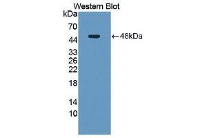 Western Blotting (WB) image for anti-Neuromedin U (NMU) (AA 35-158) antibody (ABIN1869481) (Neuromedin U anticorps  (AA 35-158))