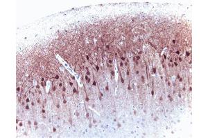ERK 2 (clone 33) staining on rat brain.