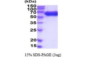 SDS-PAGE (SDS) image for Alkaline Phosphatase, Liver/bone/kidney (ALPL) (AA 19-503) (Active) protein (His tag) (ABIN6387919) (ALPL Protein (AA 19-503) (His tag))