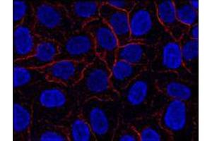 Immunofluorescence (IF) image for anti-AHNAK Nucleoprotein (AHNAK) (N-Term) antibody (ABIN263928)