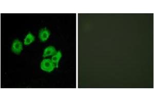 Immunofluorescence analysis of HuvEc cells, using CLTR1 Antibody. (CysLTR1 anticorps  (AA 131-180))
