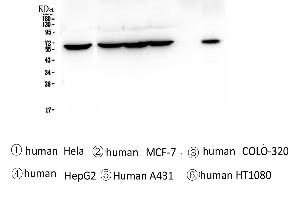 Western blot analysis of TCP1 alpha using anti-TCP1 alpha antibody . (TCP1 alpha/CCTA anticorps  (C-Term))