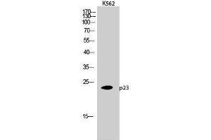Western Blotting (WB) image for anti-Cyclin-Dependent Kinase 5, Regulatory Subunit 1 (p35) (CDK5R1) (Tyr579) antibody (ABIN3180222) (CDK5R1 anticorps  (Tyr579))