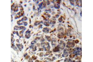 Used in DAB staining on fromalin fixed paraffin-embedded Pancreas tissue (PIK3C2A anticorps  (AA 349-611))