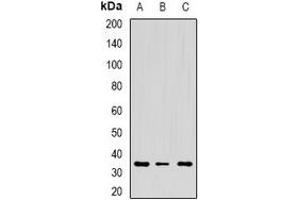 Western blot analysis of CD272 expression in mouse spleen (A), mouse thymus (B), rat lung (C) whole cell lysates. (BTLA anticorps)